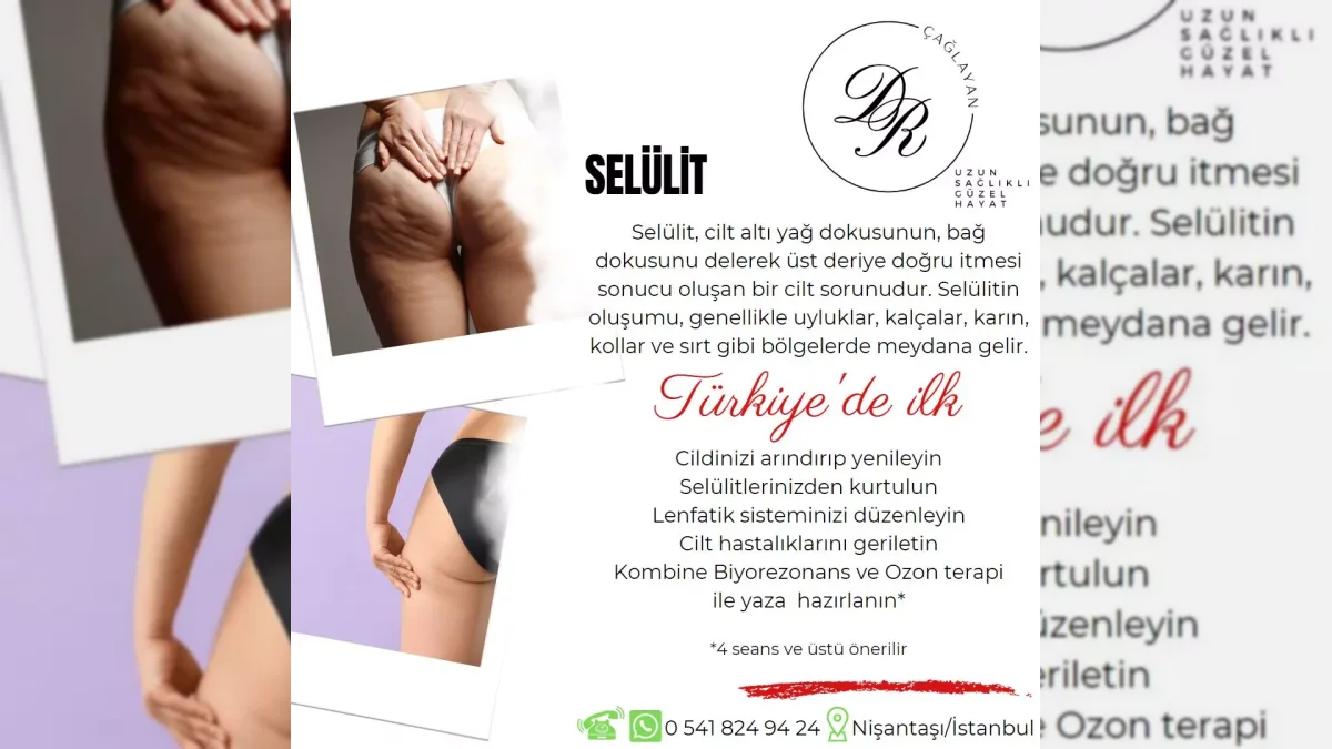 Selülit görünümünü ve cilt dokusunu temsil eden görsel – yatay arşiv kapağı